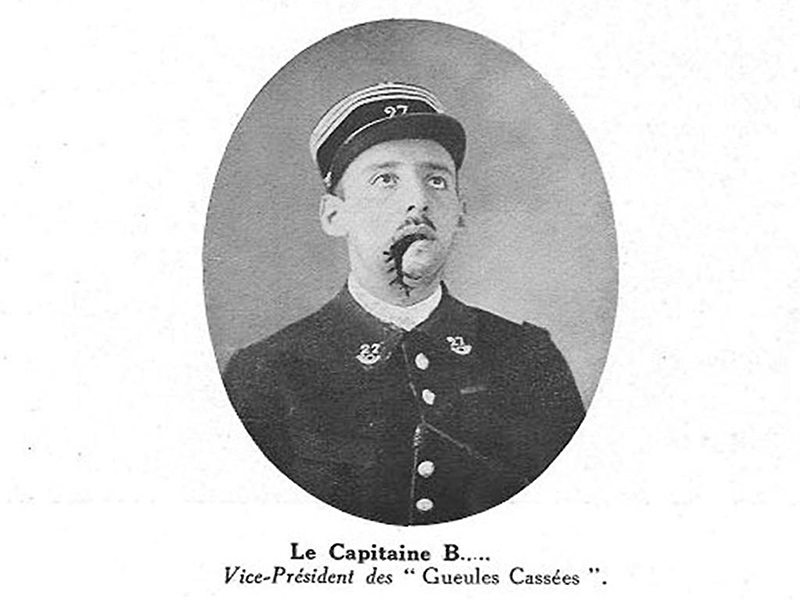 Capitaine B., vice-président des gueules cassées